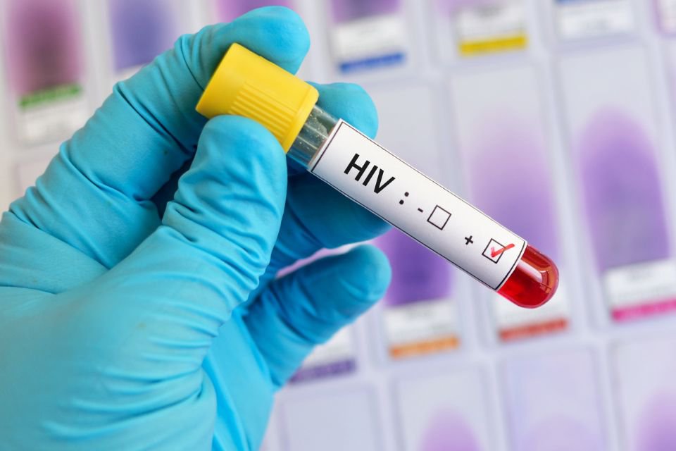 HIV: os avanços e gargalos para 2023